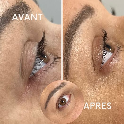 REHAUSSEMENT DES CILS